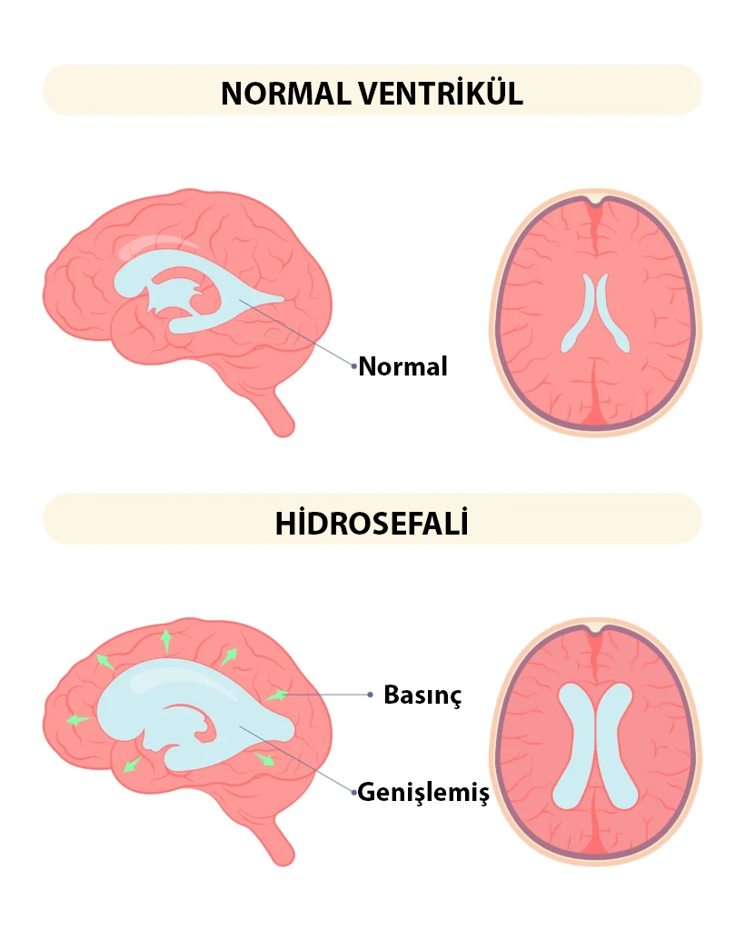 kafatası anatomisi