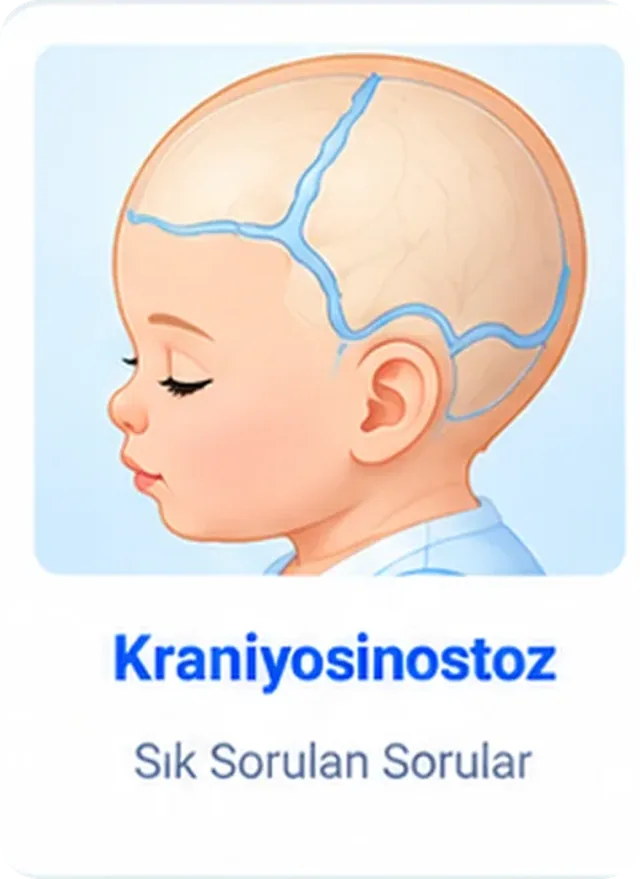 craniosynostosis