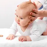 Premature fontanel closure