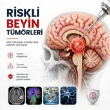 Riskli Beyin Tümörleri